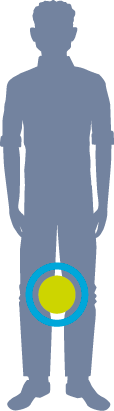 PC Icon_Swelling